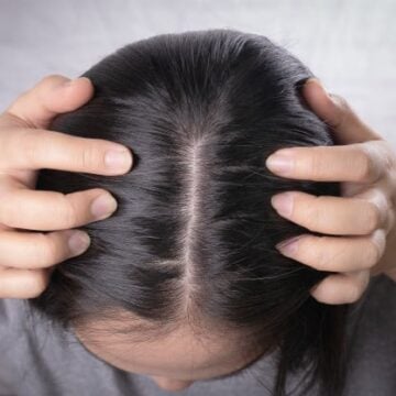 التخلص من جفاف وهيشان الشعر بمواد طبيعية في المنزل ونتيجة خرافية في أقل وقت